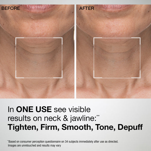 Tl 6 Mask TL Advanced® Sculpting Neck & Jawline Mask
