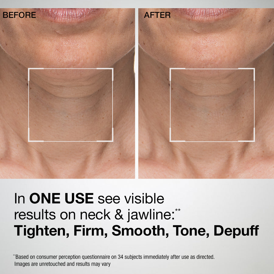 TL Advanced® Sculpting Neck & Jawline Mask