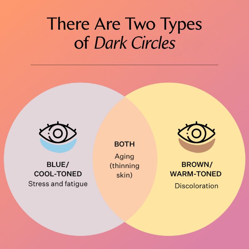 Dark circles under eyes