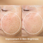 Super-C Retinol Brighten & Correct Vitamin C Serum