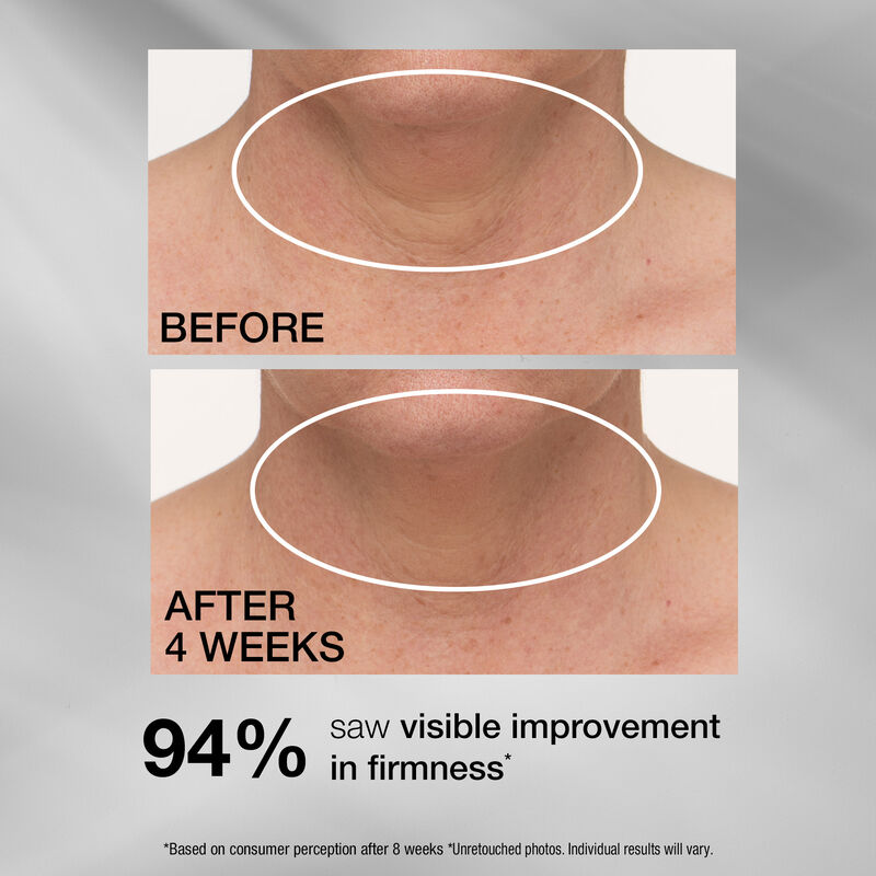 TL Advanced™ Tightening Neck Cream PLUS