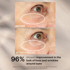 Peptight™ 360˚ Tightening Eye Serum, , hi-res
