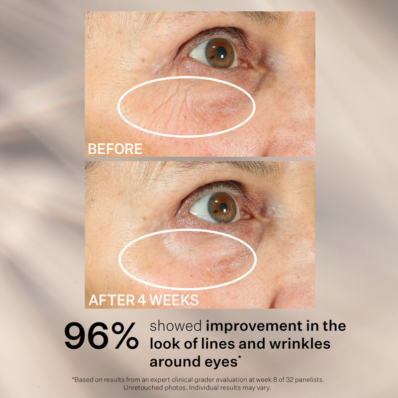 Peptight™ 360˚ Tightening Eye Serum, , hi-res
