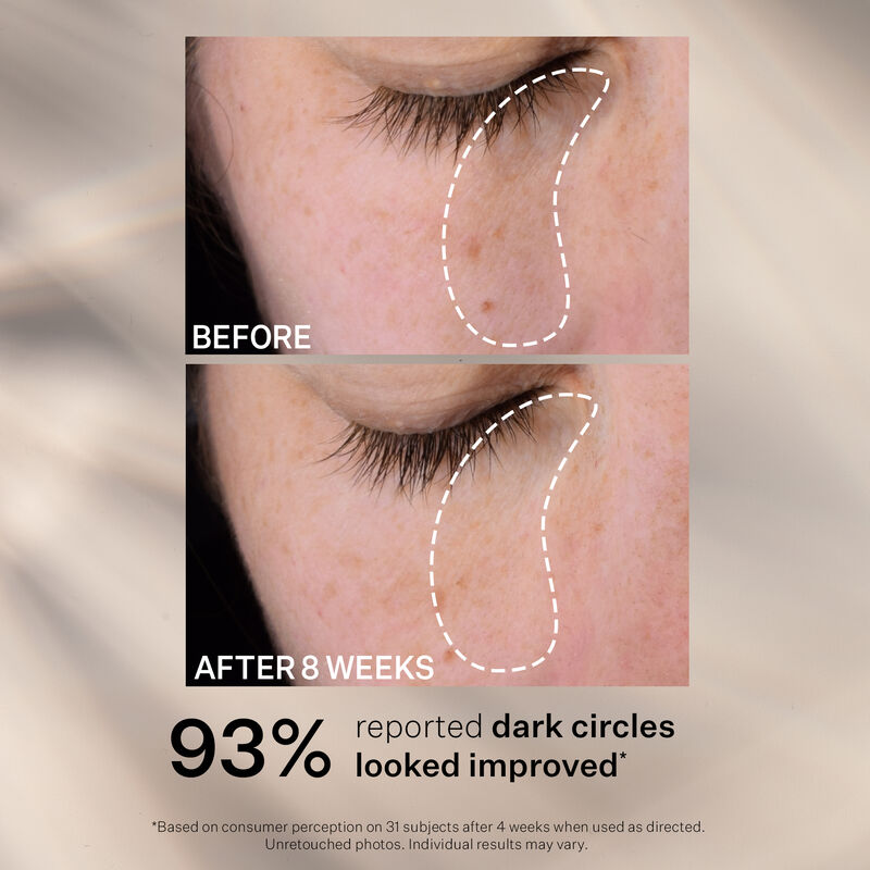 Super-C Dark Circle Brightening Eye Serum, , hi-res