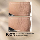 SD Advanced™ Plus Intensive Moisturizer