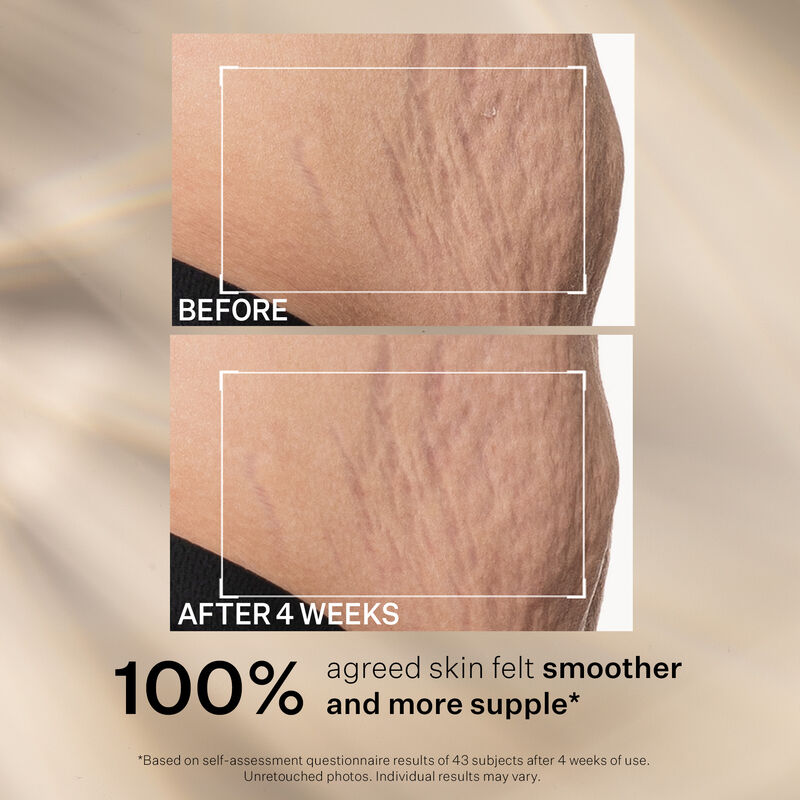 SD Advanced™ Plus Intensive Moisturizer