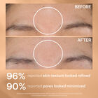 Daily Reveal™ Exfoliating Pads, , hi-res