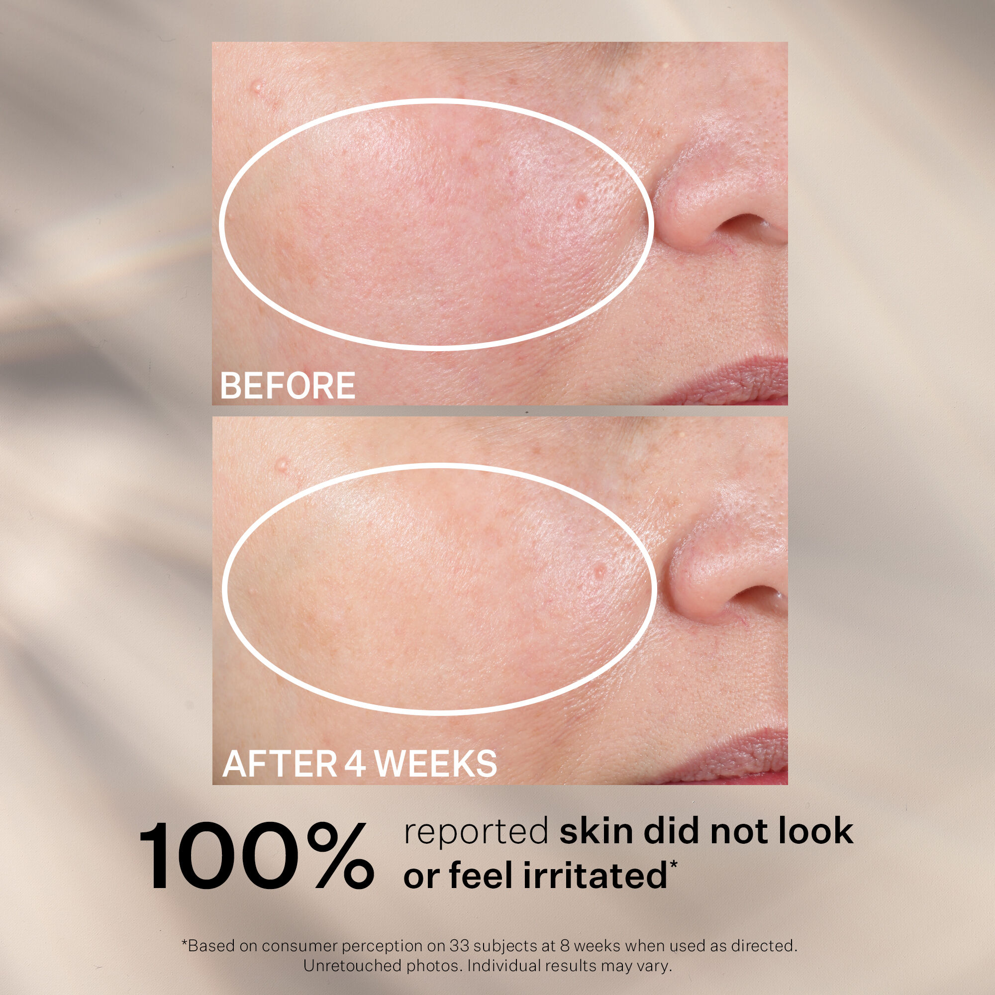 Advanced Retinol Nightly Renewal Moisturizer | Strivectin US