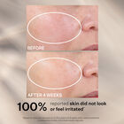 Advanced Retinol Nightly Renewal Moisturizer