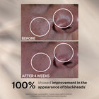 Super Shrink Pore Minimizing Serum, , hi-res