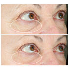 Hyperlift Eye™ Instant Eye Fix, , hi-res