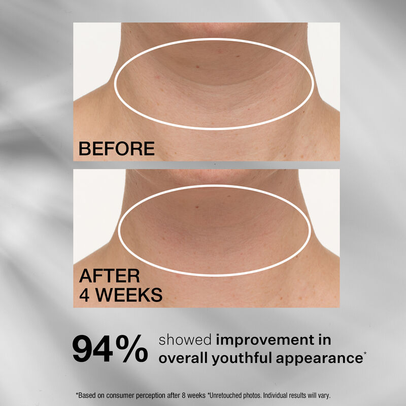 TL Advanced™ Tightening Neck Cream PLUS