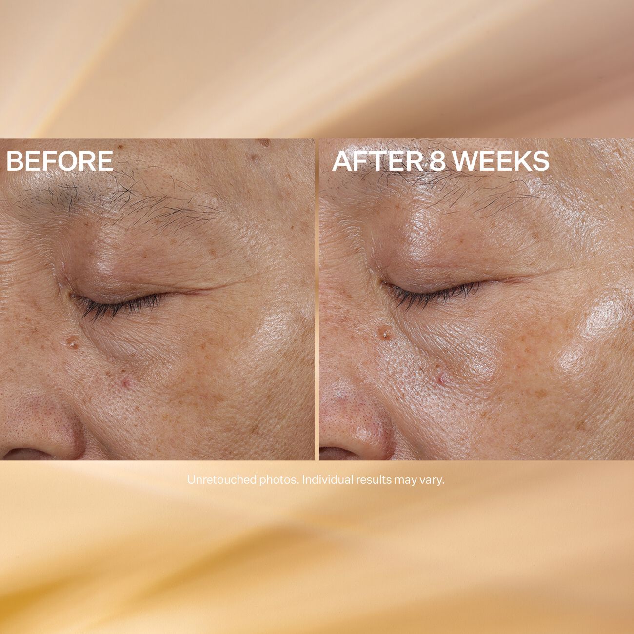 Super-C Eye Vitamin C Eye Cream | StriVectin US | Strivectin US Super-C Eye Vitamin C Eye Cream | StriVectin US | Strivectin US