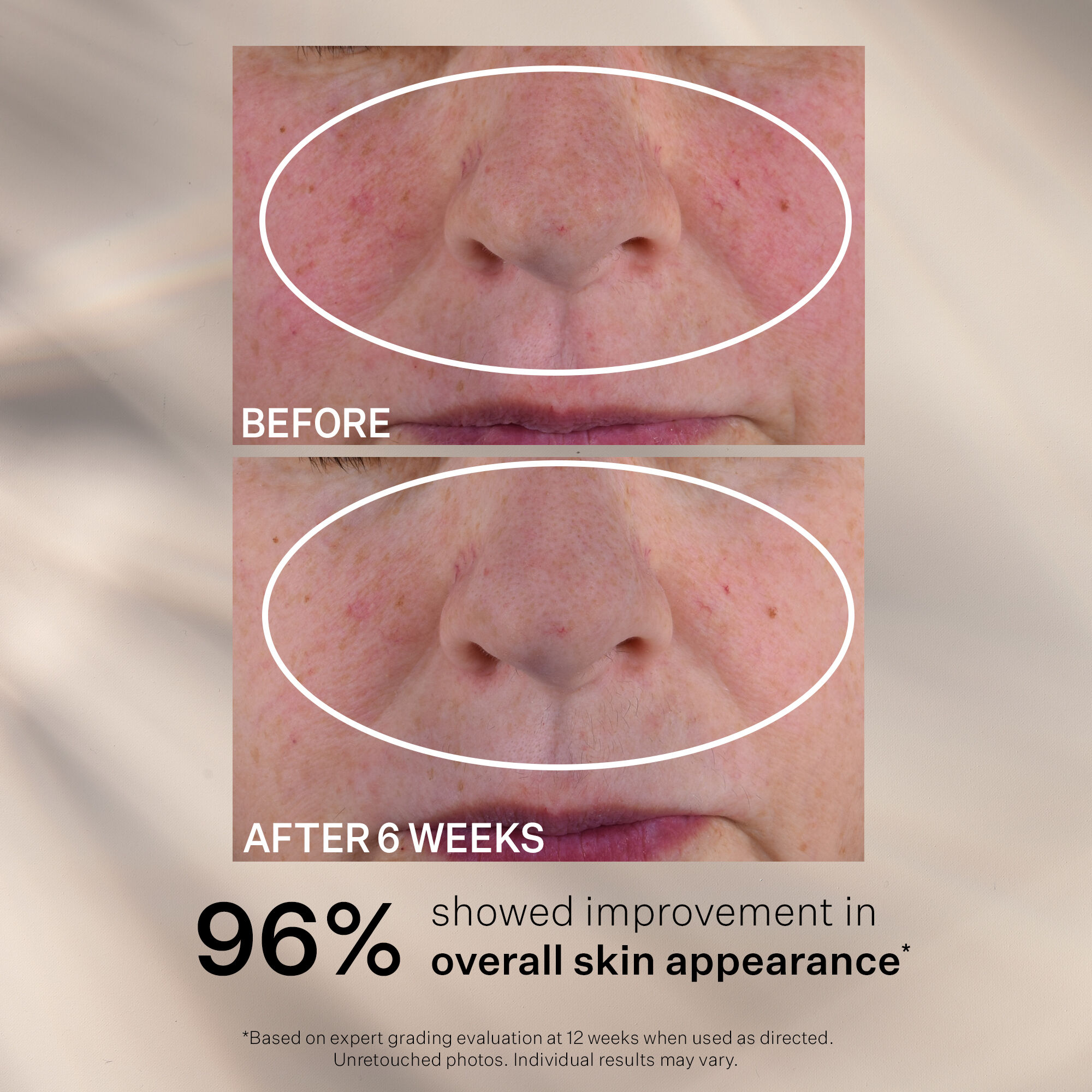 Night  Risk,Uncertainty,& Profit ナイト リスク Advanced Retinol Nightly Multi-Correct Serum | Strivectin US