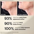 Peptight™ Tightening Neck Serum Roller, , hi-res