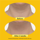 TL Advanced™ Tightening Neck Cream PLUS