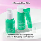 Multi-Action Clear Acne Control System Kit, , hi-res