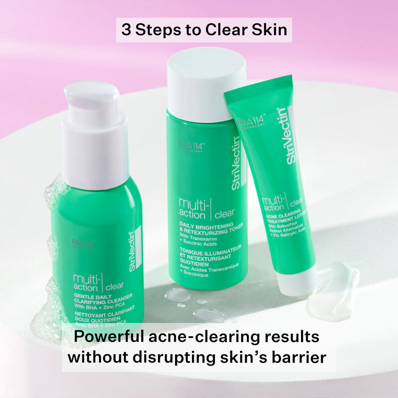 Multi-Action Clear Acne Control System Kit, , hi-res