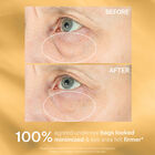 Hyperlift Eye™ Instant Eye Fix, , hi-res