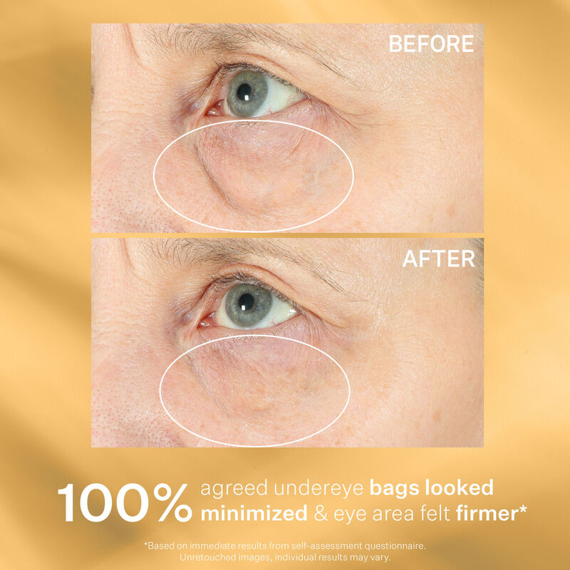 Hyperlift Eye™ Instant Eye Fix, , hi-res