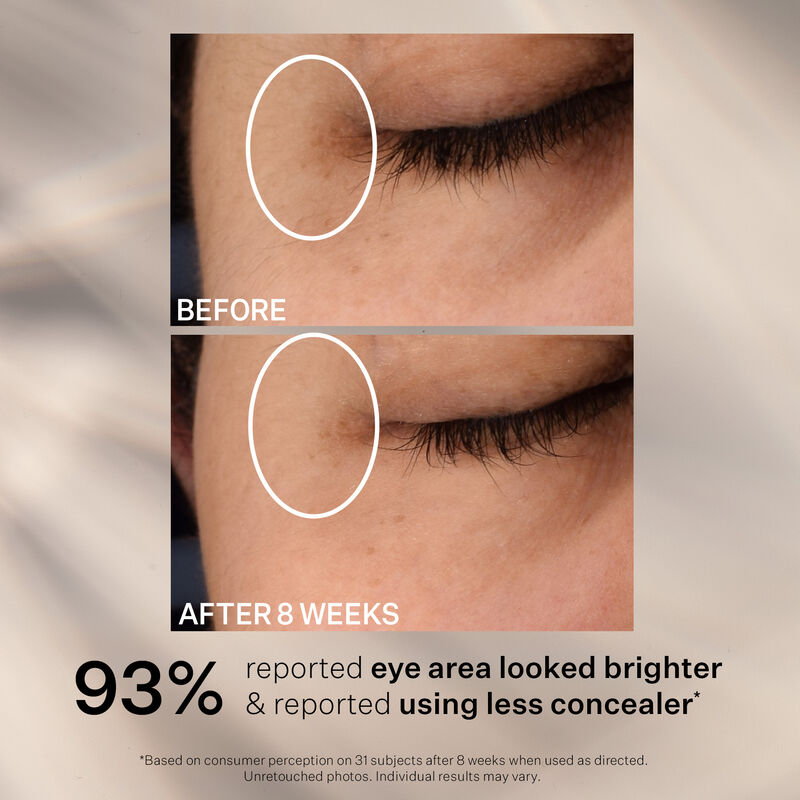 Super-C Dark Circle Brightening Eye Serum, , hi-res