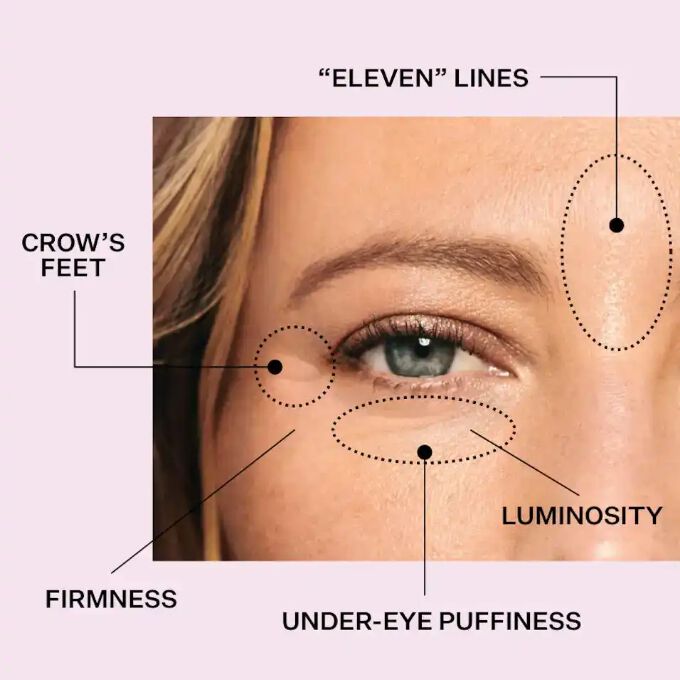 Fine lines under new arrivals eyes at 25