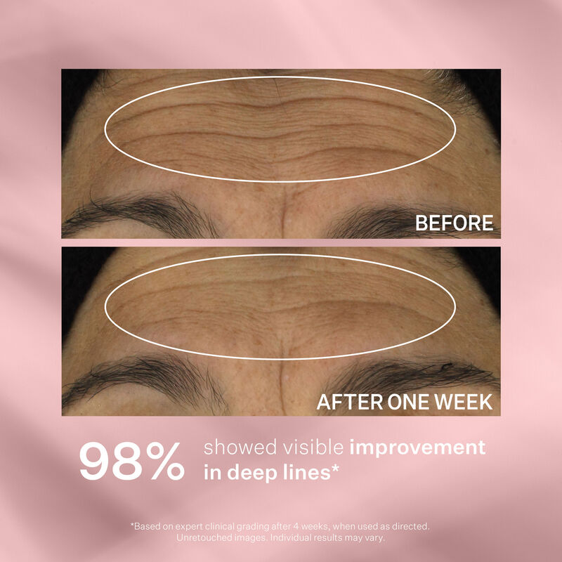 Wrinkle Recode™ Line Transforming Melting Serum, , hi-res