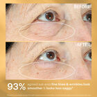 Hyperlift Eye™ Instant Eye Fix, , hi-res