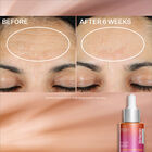 Super-C Retinol Brighten & Correct Vitamin C Serum, , hi-res