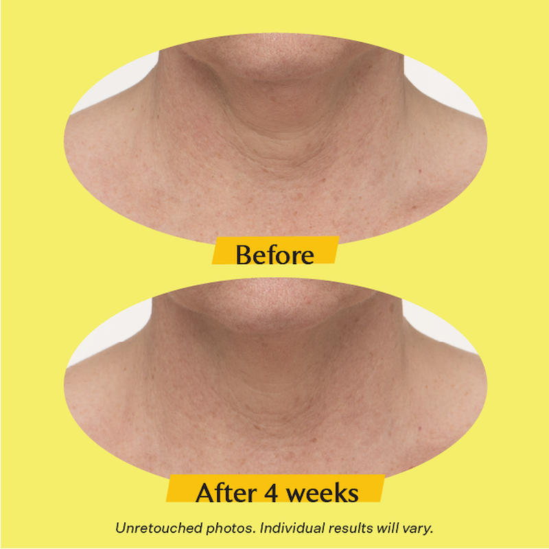 TL Advanced™ Tightening Neck Cream PLUS Strivectin US Strivectin US